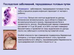 Симптомы заболевания Как лечить заболевание