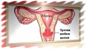 Механизм возникновения и причины патологии