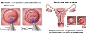 Методы лечения недуга