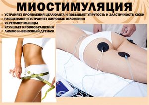 Миостимуляция: что это и как работает