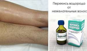 Методы обесцвечивания волос на теле Обесцвечивания волос