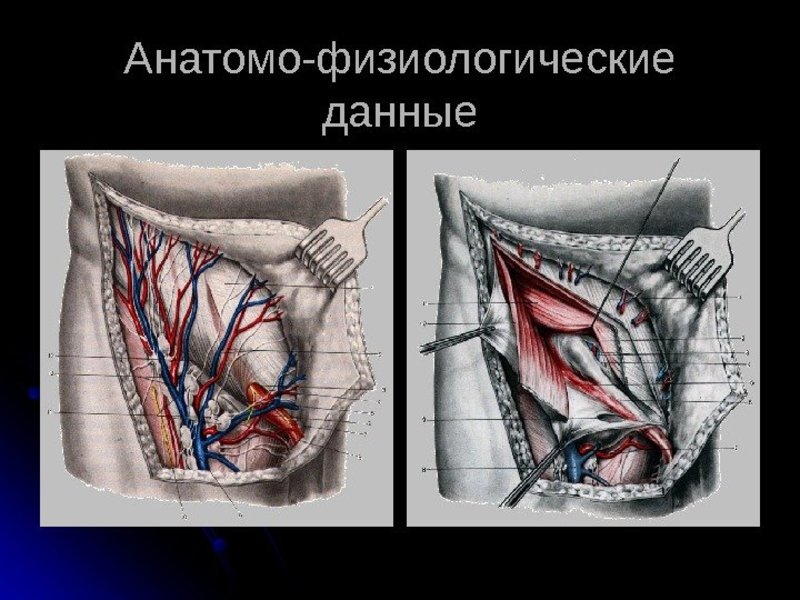 Чем опасна паховая грыжа у женщин