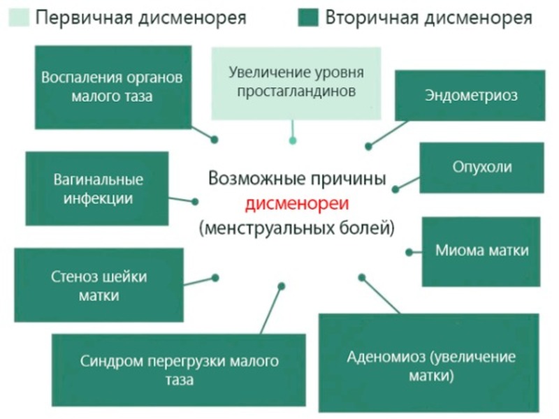Основные разновидности дисменореи