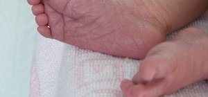 Почему кожа сохнет у ребенка