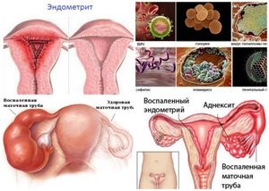 Причины формирования