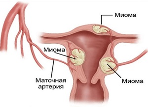 Причины развития женского недуга