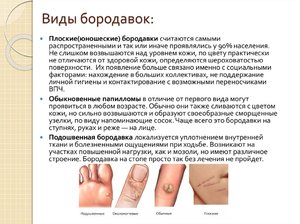 Причины возникновения бородавок на руках