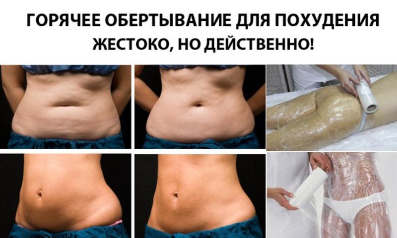 Процедуры для уменьшения живота