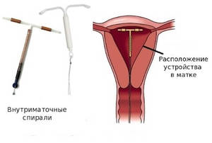 Противопоказания метода