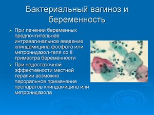 Виды заболевания Как проявляется вагиноз