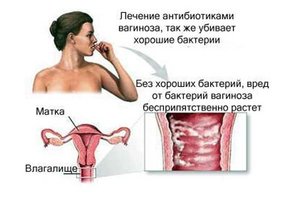 Причины заболевания Как проявляется заболевание