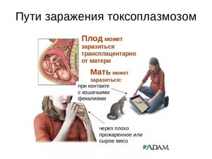 Как можно заразиться Токсоплазмозом Пути заражения Токсоплазмозом