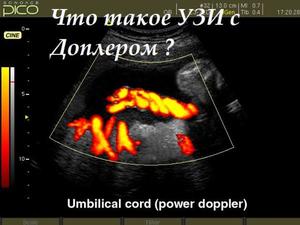 Расшифровка узи снимка Расшифровка узи