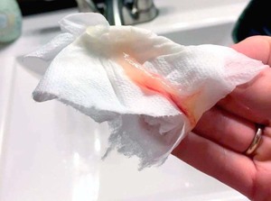 Розовые выделения