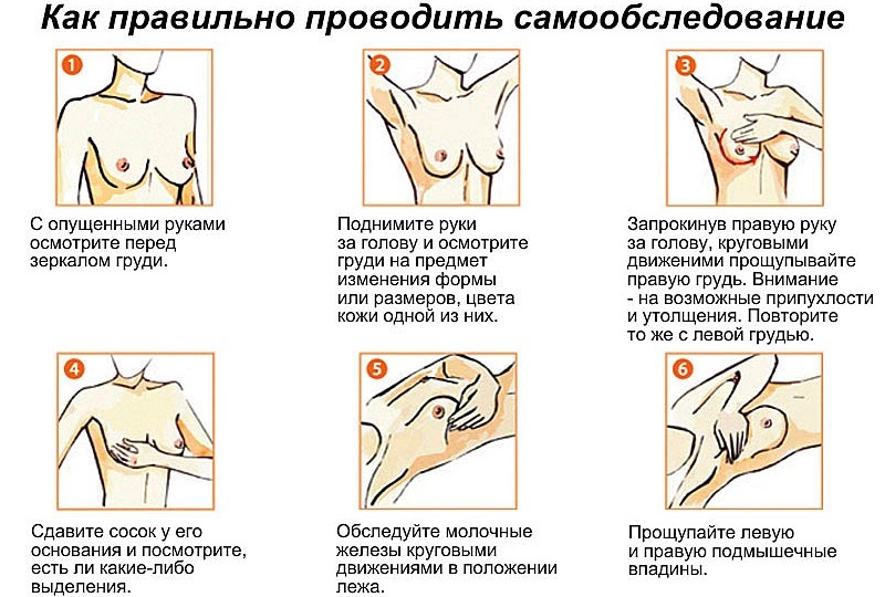 Самообследование на рак молочной железы