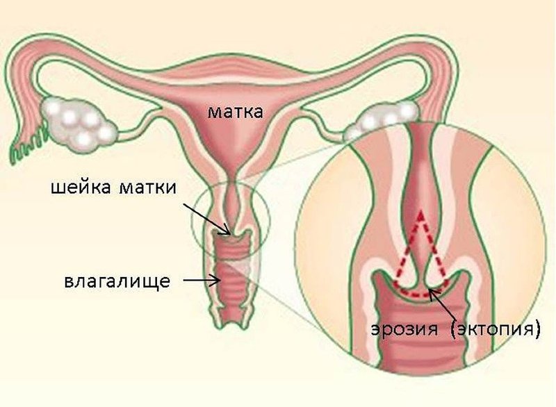 Симптоматика патологии