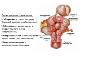 Симптомы и причины