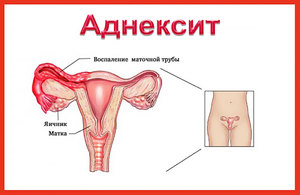 Симптомы заболевания