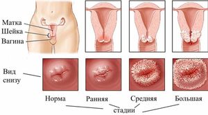 Способы диагностики заболевания