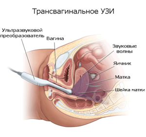 Способы диагностирования