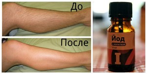 Народные способы удаления волос на теле Способы удаления волос на теле