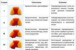 Описание симптомов геморроя на каждой стадии Описание симптомов геморроя на каждой стадии