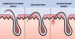 Таблетки аспирина