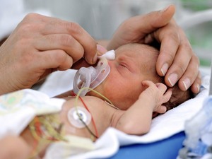 Тактика при преждевременных родах