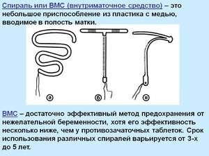 Внутриматочная спираль: принцип действия
