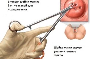 Возможные осложнения