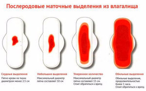 Выделения после родов (лохии): виды, сколько идут Выделения после родов (лохии): виды