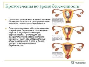 Причины выделений при беременности Выделения во время беременности