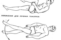 Упражнения при геморрое Упражнения при геморрое