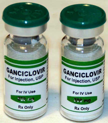 lechenie-citomegalovirusa-ganciklovir излечение ганцикловиром