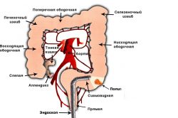 Строение толстого кишечника Строение толстого кишечника